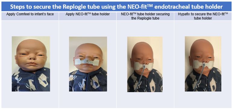 Replogle steps to secure